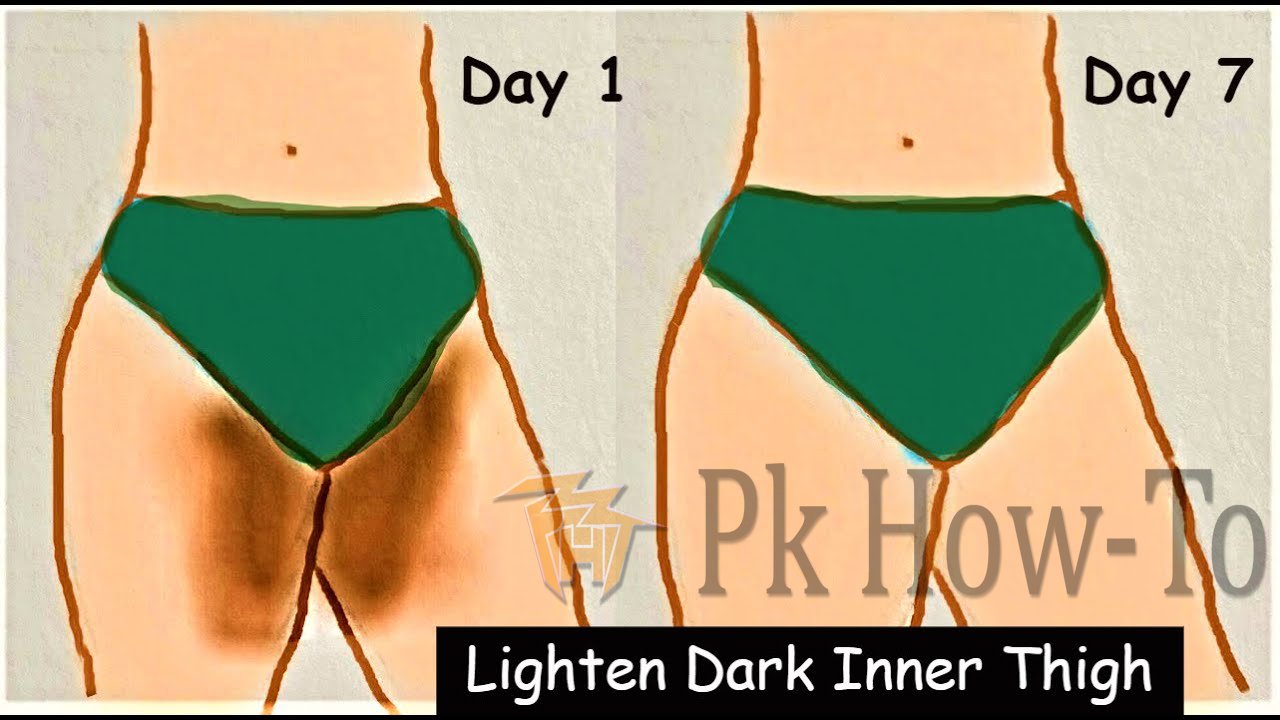 How To Whiten Your Dark Inner Thighs